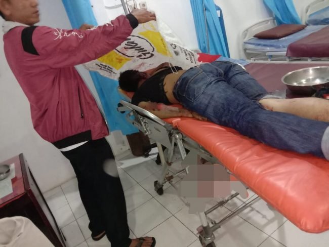Digilas Truk Tronton, Pegawai Honor BPBD Batu Bara Tewas di Tempat