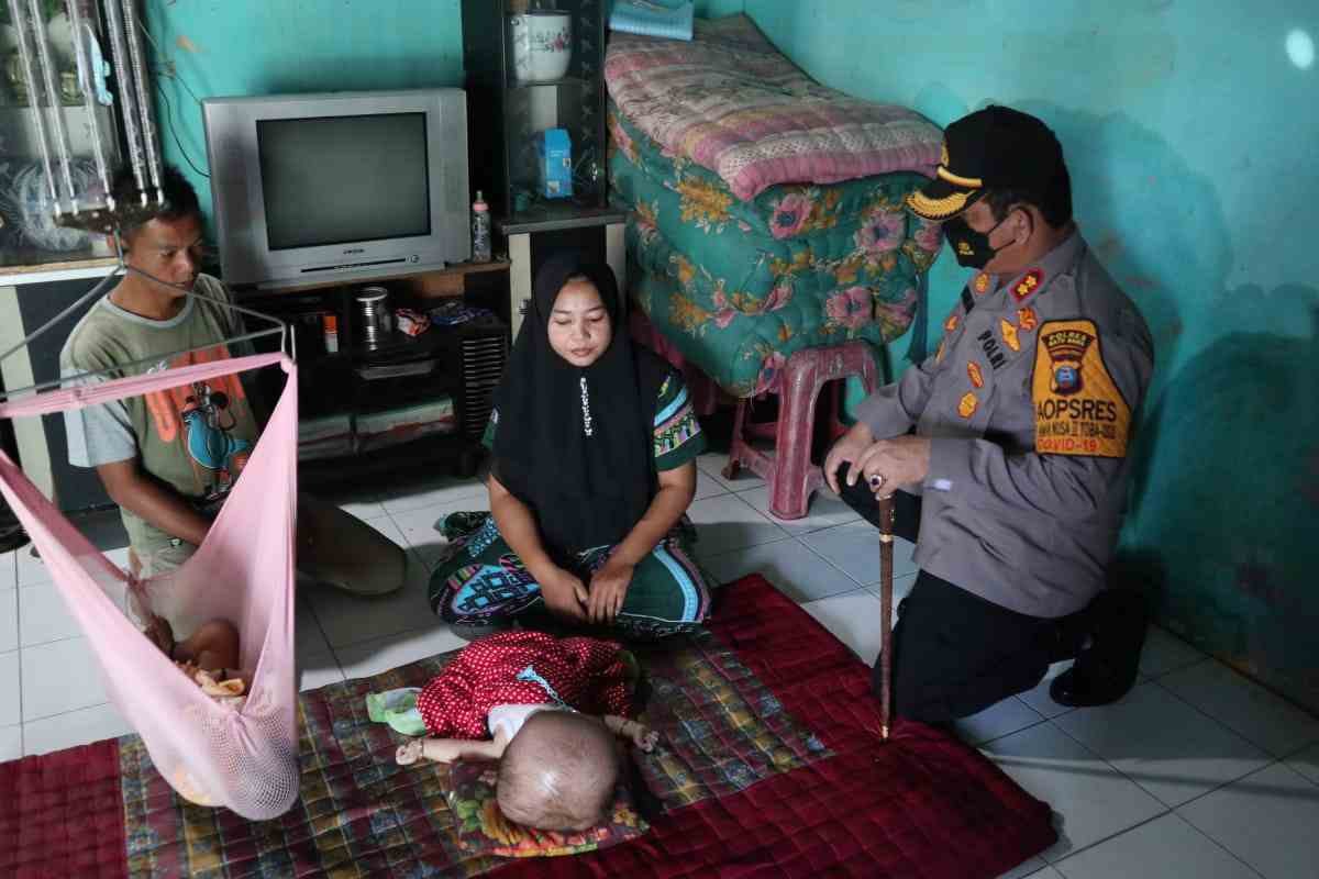 Kapolres Batu Bara Kunjungi Satria Pratama Bocah Penderita Hidrosefalus