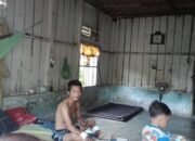 Kesetrum Listrik, Tangan Kiri di Amputasi, Legiarto Kehilangan Mata Pencaharian