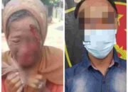 Tega ! Anak Aniaya Ibu Kandung Hingga Pelipis Keluarkan Darah