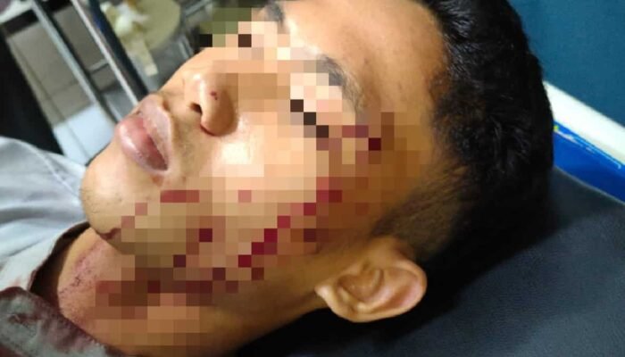Saling Ejek Dua Remaja Batu Bara Duel Satu Kritis Ditikam