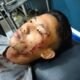 Korban MH Maulana terbaring kritis di Klinik Harun Desa Lalang. Sabtu (19/03/2022). (Foto/ Istimewa).