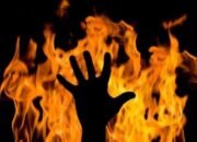Disiram Bensin Gara-gara Diduga Mencuri Ikan Asin, Seorang Remaja di Belawan Terbakar