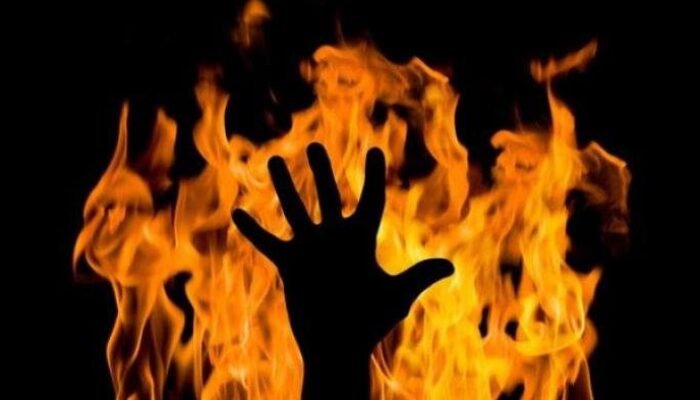 Disiram Bensin Gara-gara Diduga Mencuri Ikan Asin, Seorang Remaja di Belawan Terbakar