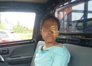 Pertikaian di Warung Tuak, Wanita Penghibur Bonyok Dilempar Gelas di Desa Pakam