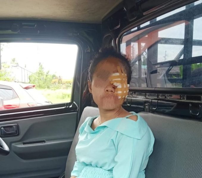 Korban Yus saat memberikan keterangan kepada wartawan sebelum melapor ke Polres Batu Bara. (Poto : Sholeh Pelka)