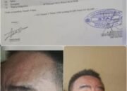 Pelaku UMKM Dianiaya Ketua OKP, Kanit Reskrim Polsek Delitua: Kasusnya Kita Proses