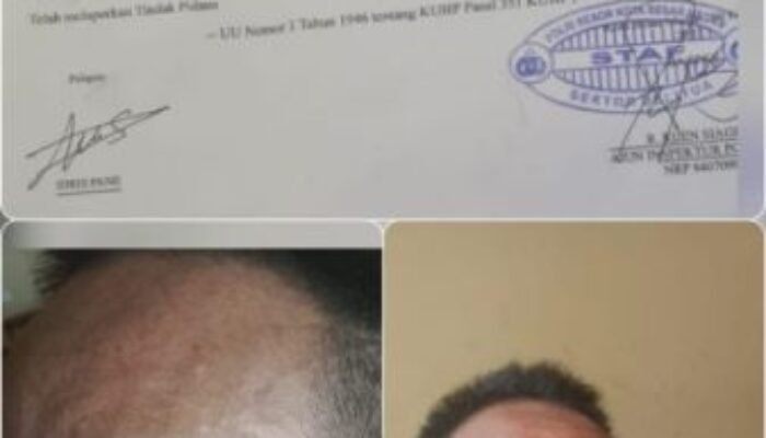 Pelaku UMKM Dianiaya Ketua OKP, Kanit Reskrim Polsek Delitua: Kasusnya Kita Proses