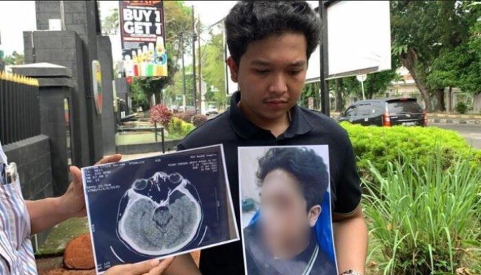 Kasat Narkoba Ngaku Diminta Uang Damai Rp 300 Juta, Keluarga Mahasiswa UISU Bantah