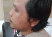 Ketua Bawaslu Sumut Minta Polisi Usut Pengeroyokan Panwas Medan Baru