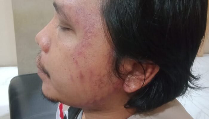 Ketua Bawaslu Sumut Minta Polisi Usut Pengeroyokan Panwas Medan Baru
