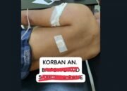 Polisi Menyamar jadi Pembeli Ditikam Pengedar Narkoba