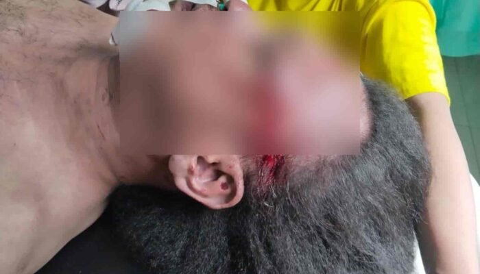 Misteri Kematian Jurnalis Nico Saragih di Medan: Luka di Tubuh, Kesaksian Mengejutkan Saksi Mata