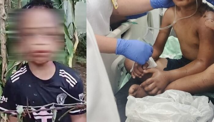 Polres Dairi Amankan Tersangka Penganiayaan Dua Anak, Ricky Anthony Minta Korban Terus Didampingi